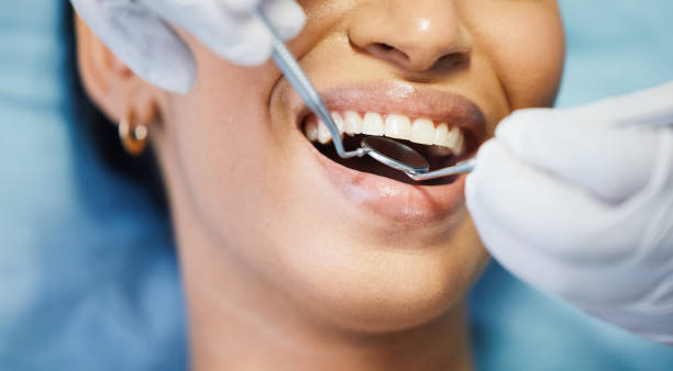 Best Emergency Root Canal Treatment in Halifax, VA