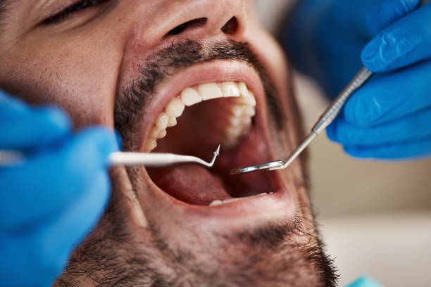 Best Same-Day Emergency Dentist in Halifax, VA