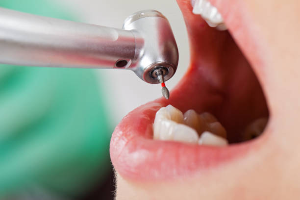 Best Pediatric Emergency Dentist in Halifax, VA
